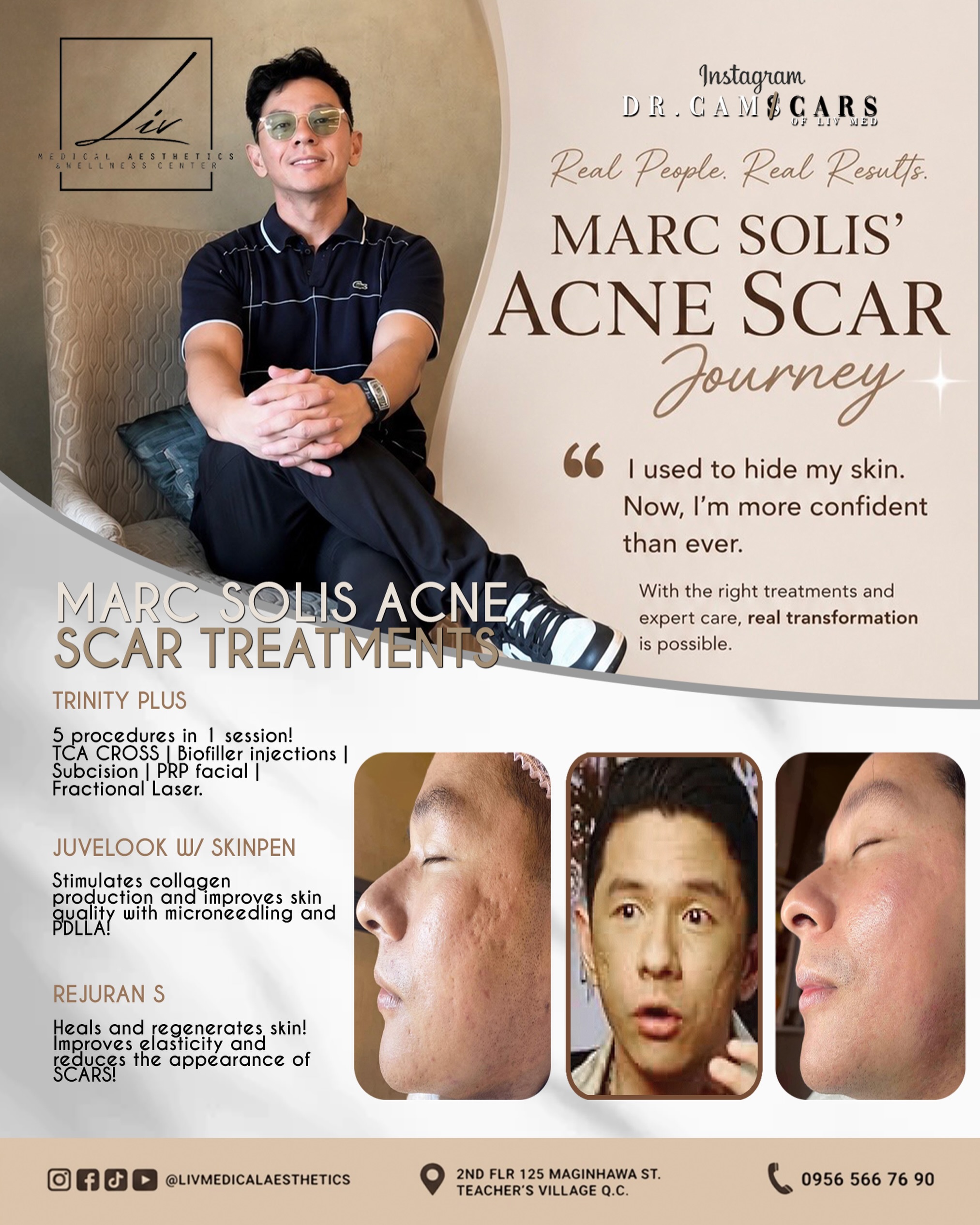 Liv Medical Aesthetics and Wellness Center Facebook ad