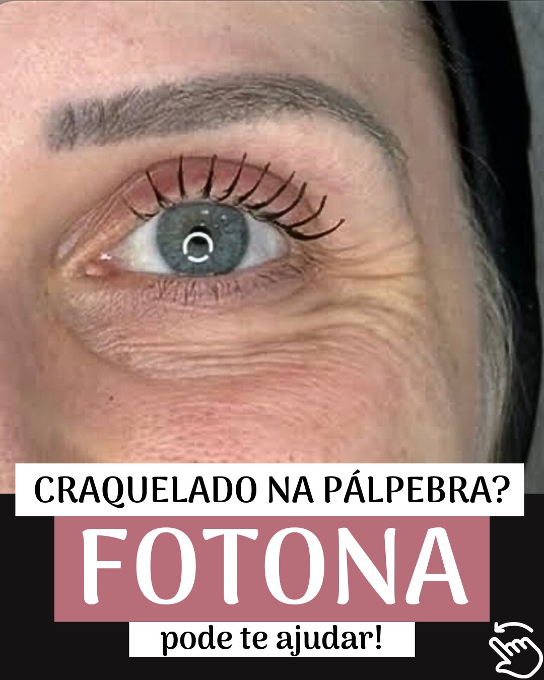 Clínica Dra. Andréa Pimentel Facebook ad: Sentindo que o corretivo destaca as ruguinhas abaixo…