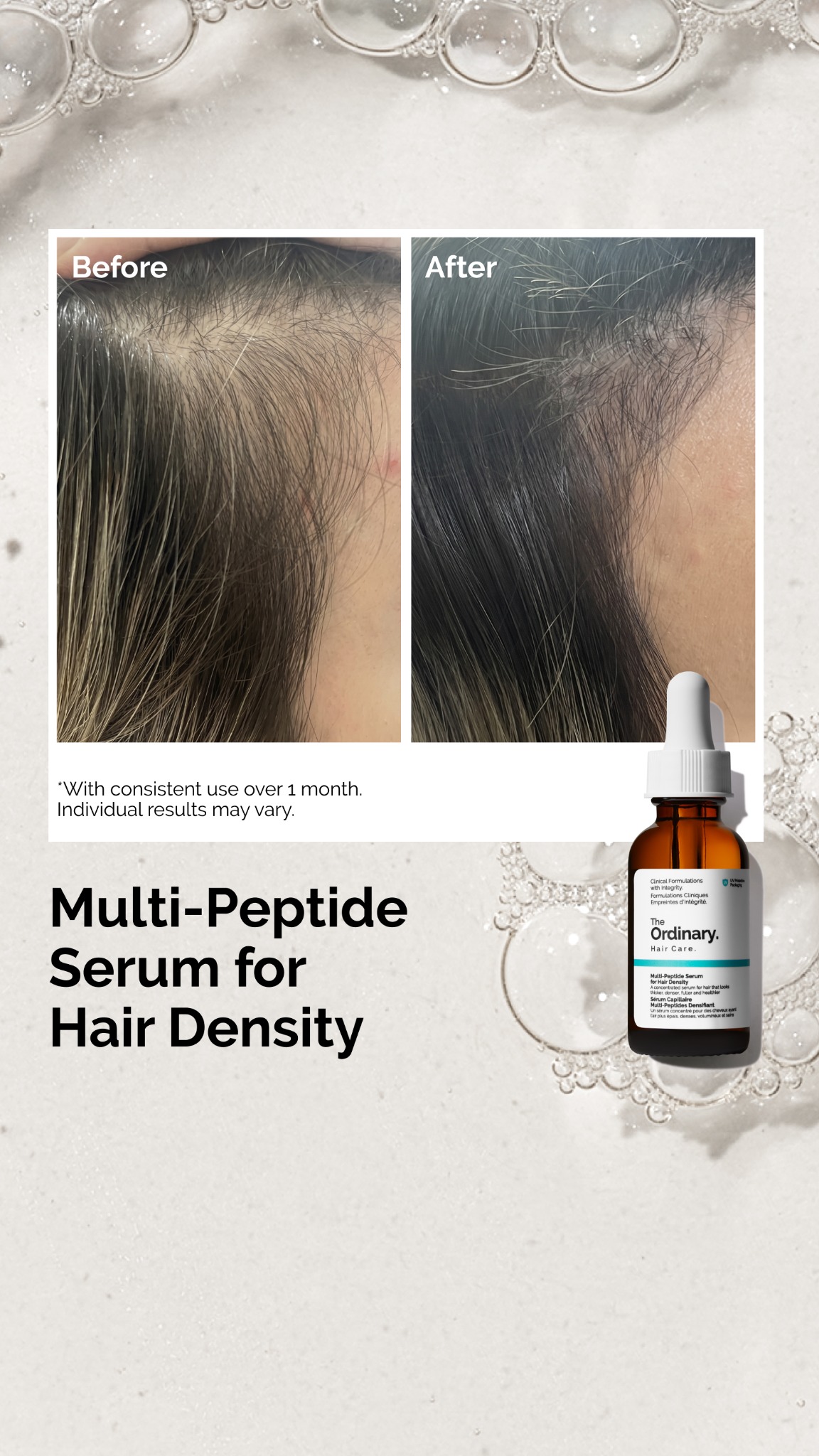 The Ordinary Facebook ad: Peptide Serum for Healthier-Looking Hair