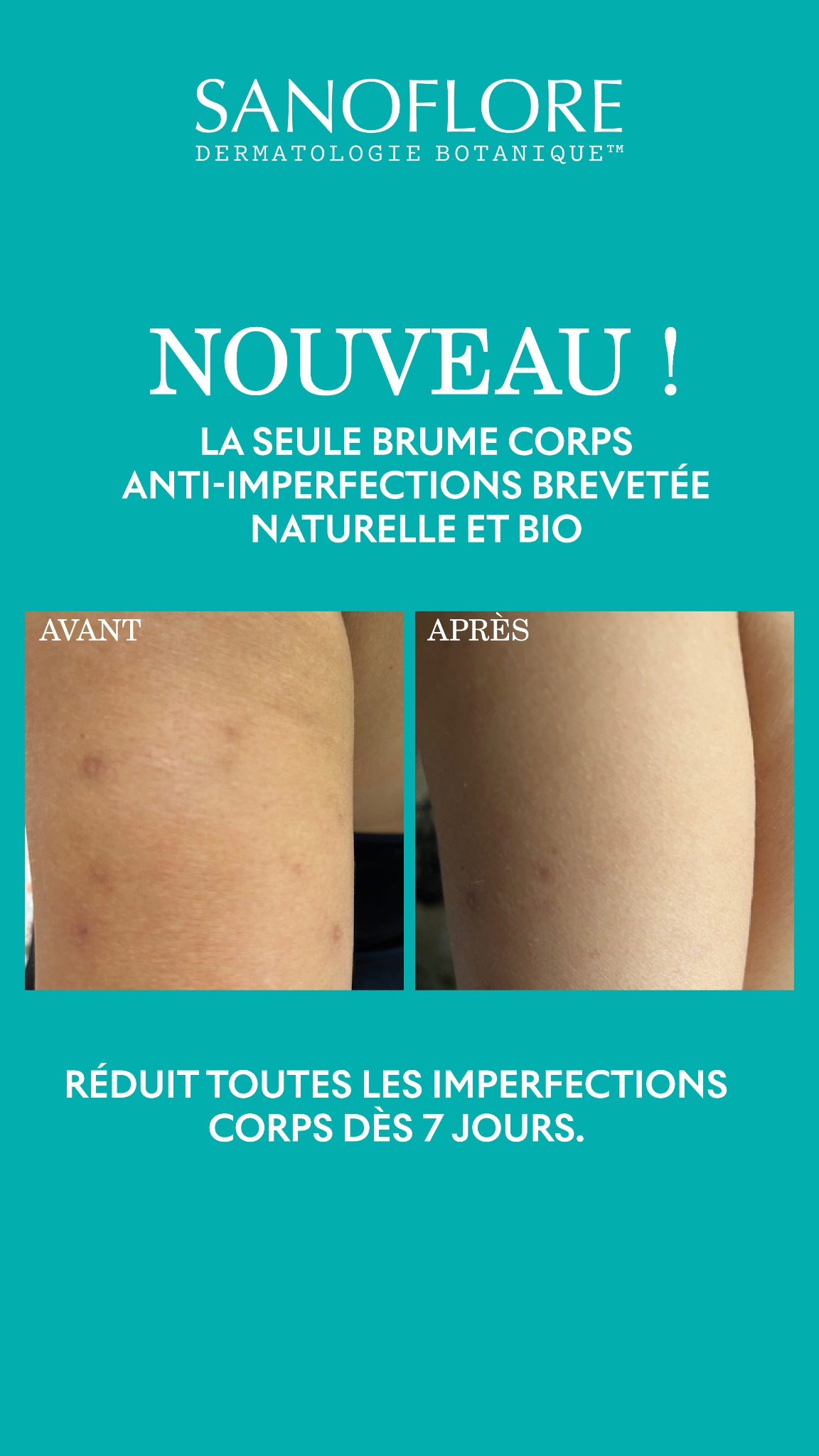 Sanoflore Facebook ad