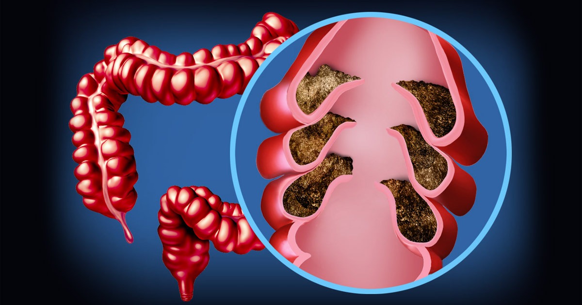 ProCombo - probiotic + prebiotic Facebook ad