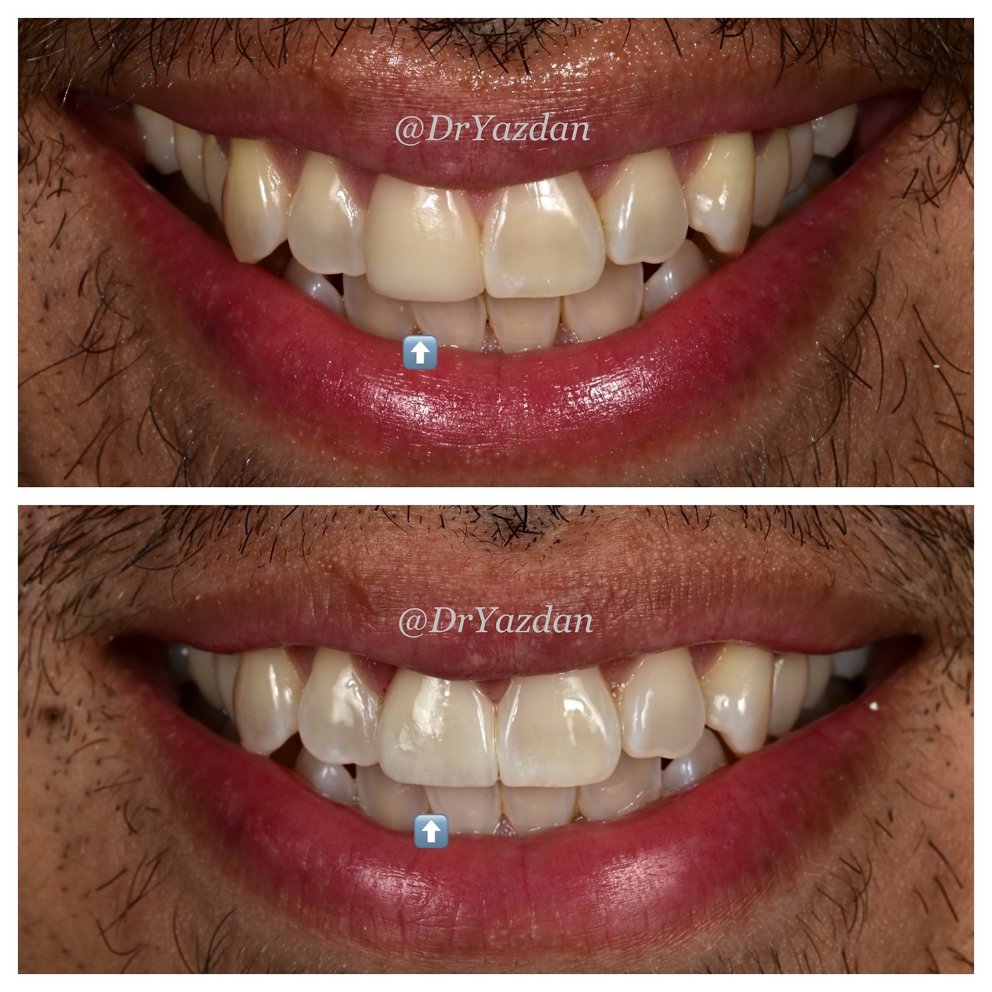 Dr. Desiree Yazdan (Dentist) Facebook ad