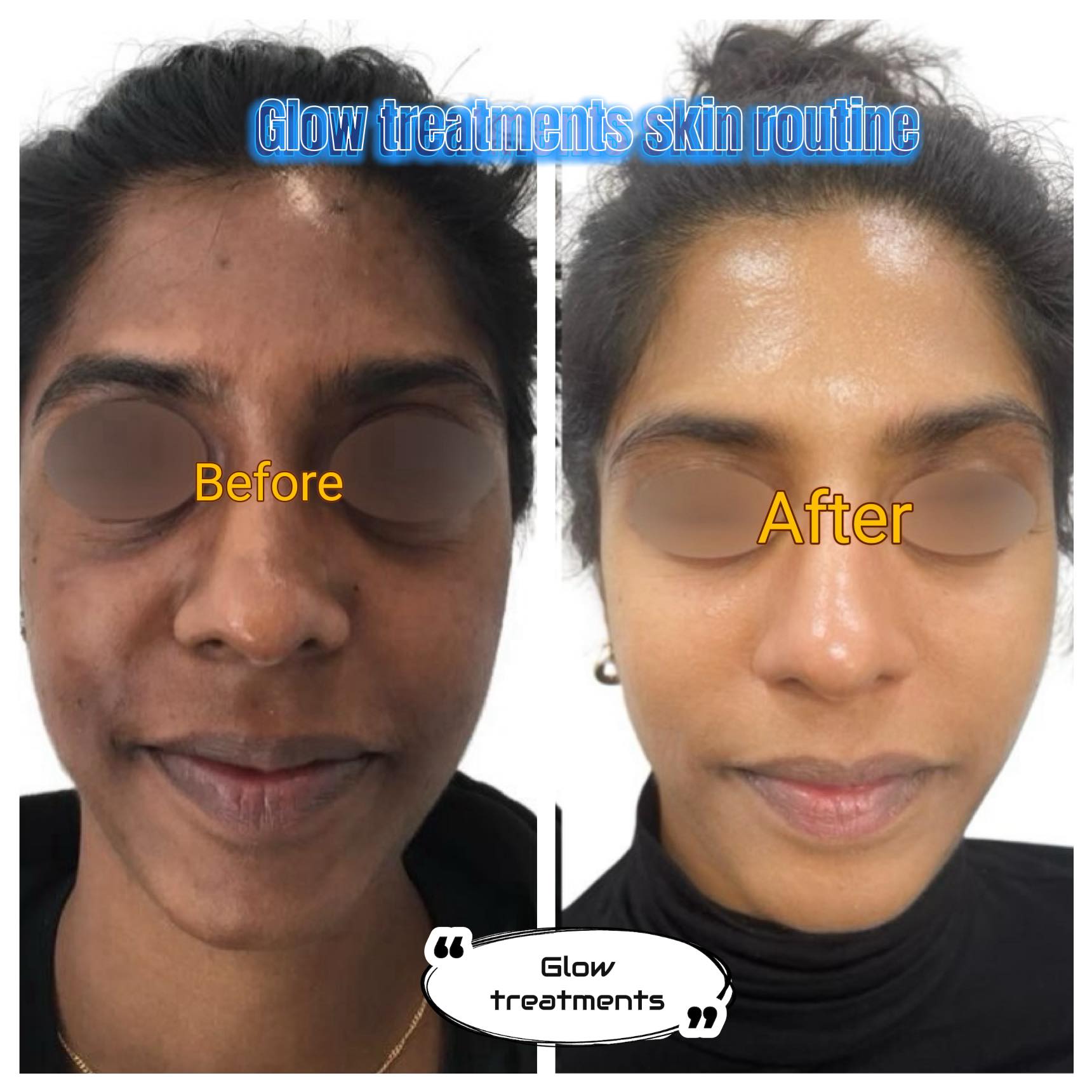 Glow Treatments Facebook ad: Get your skincare routine back on track
