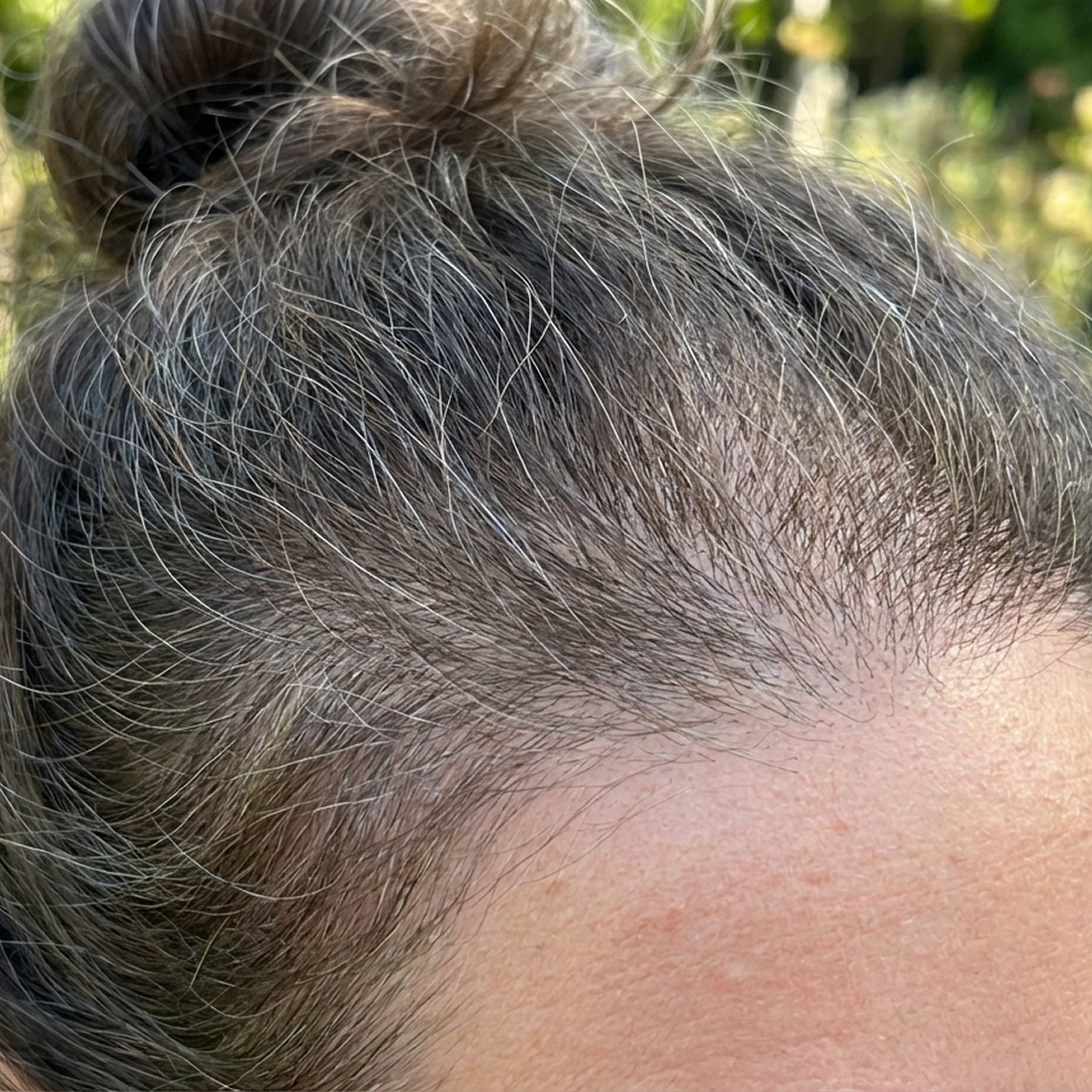 Jennifer Nelson Facebook ad: Reverse GLP-1 Hair Loss