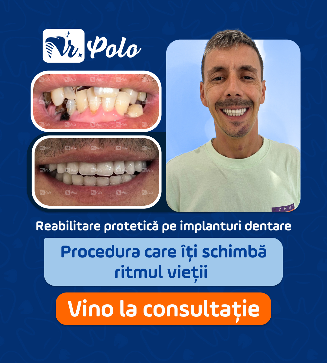 Dr. Alexandru Polonic - Chirurg dento-alveolar Facebook ad from Jan 29, 2026