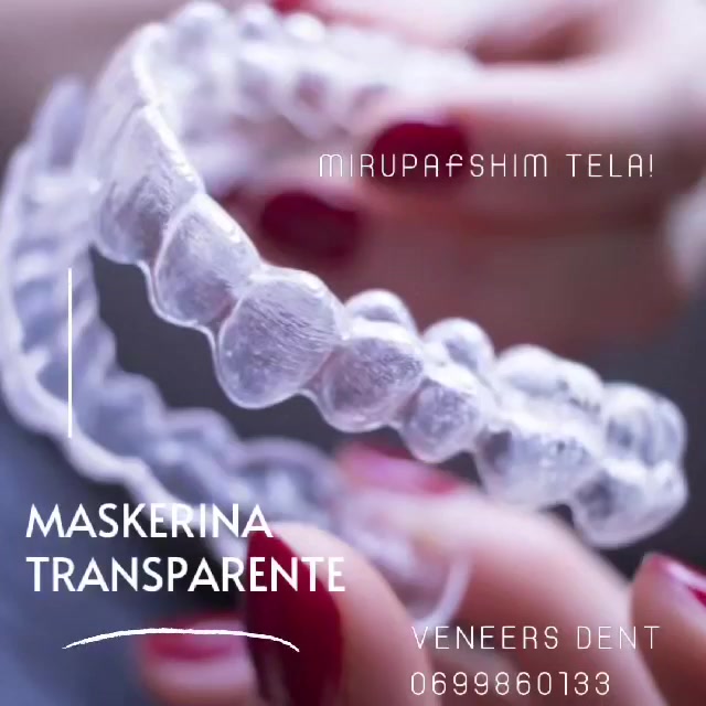 Veneers Dent Albania Facebook ad