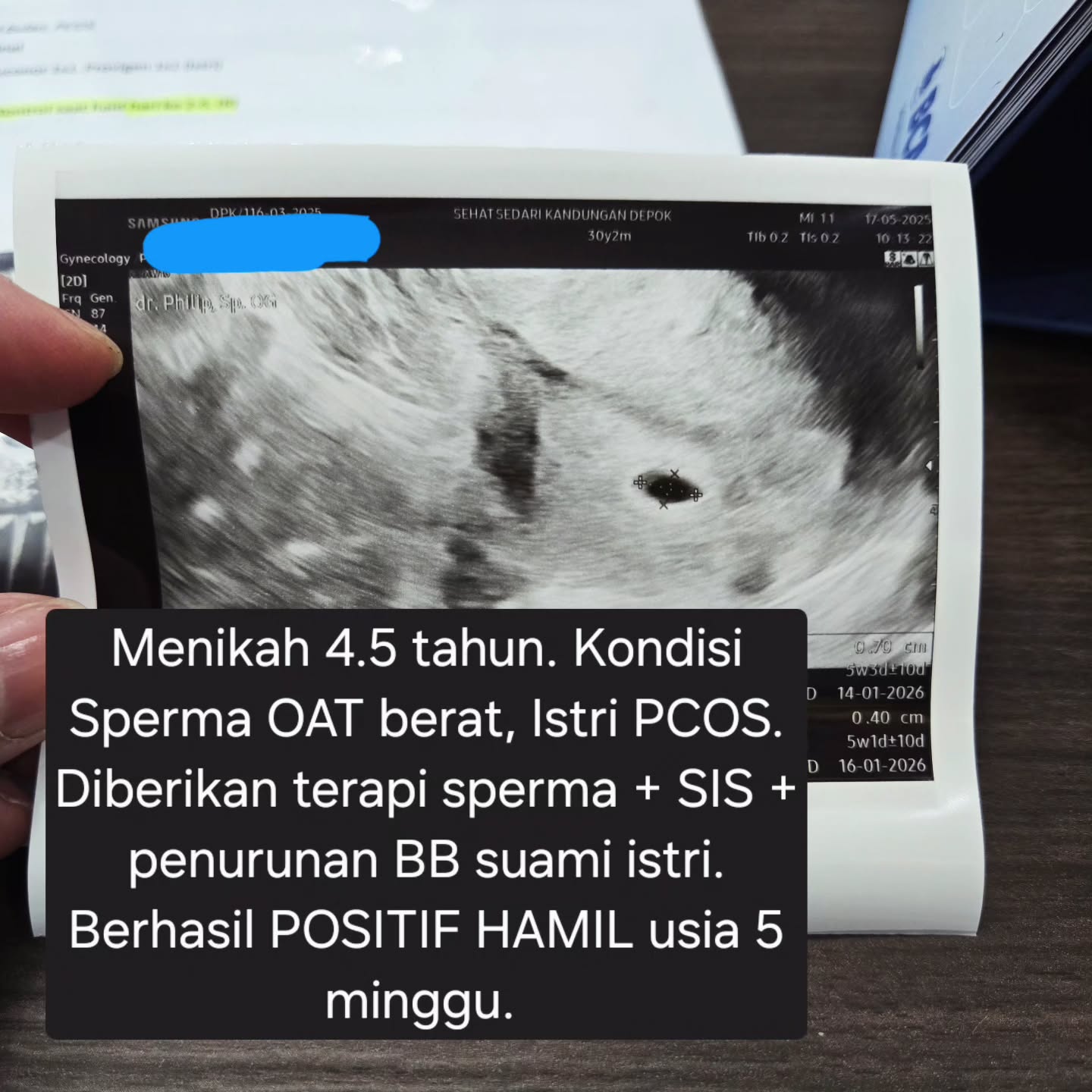 drphilipspog Facebook ad: Menikah sudah 4.5 tahun…
