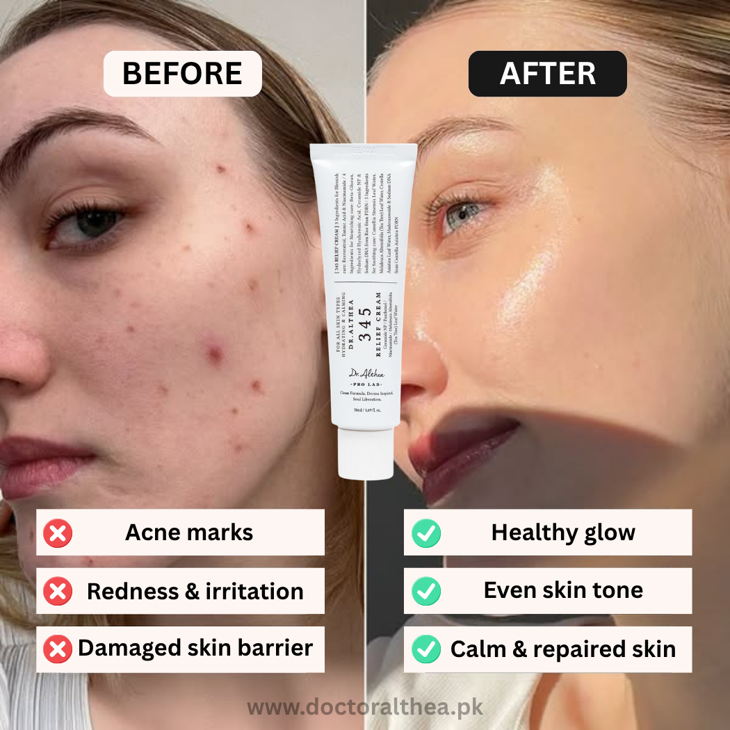 Dr. Althea Pakistan Facebook ad: Acne Marks Not Fading?