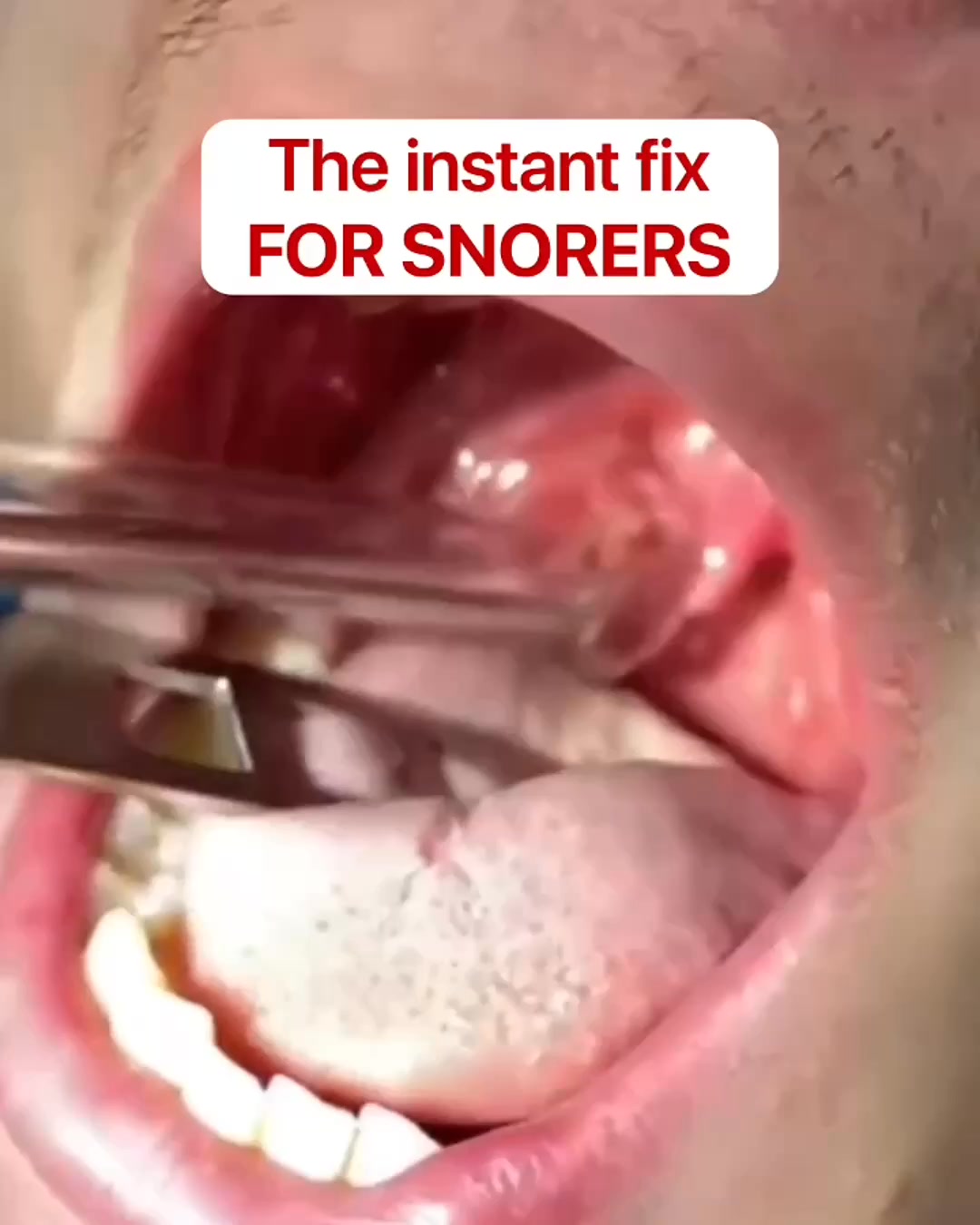 Honex Facebook ad: Fix Snoring & Sleepless Nights