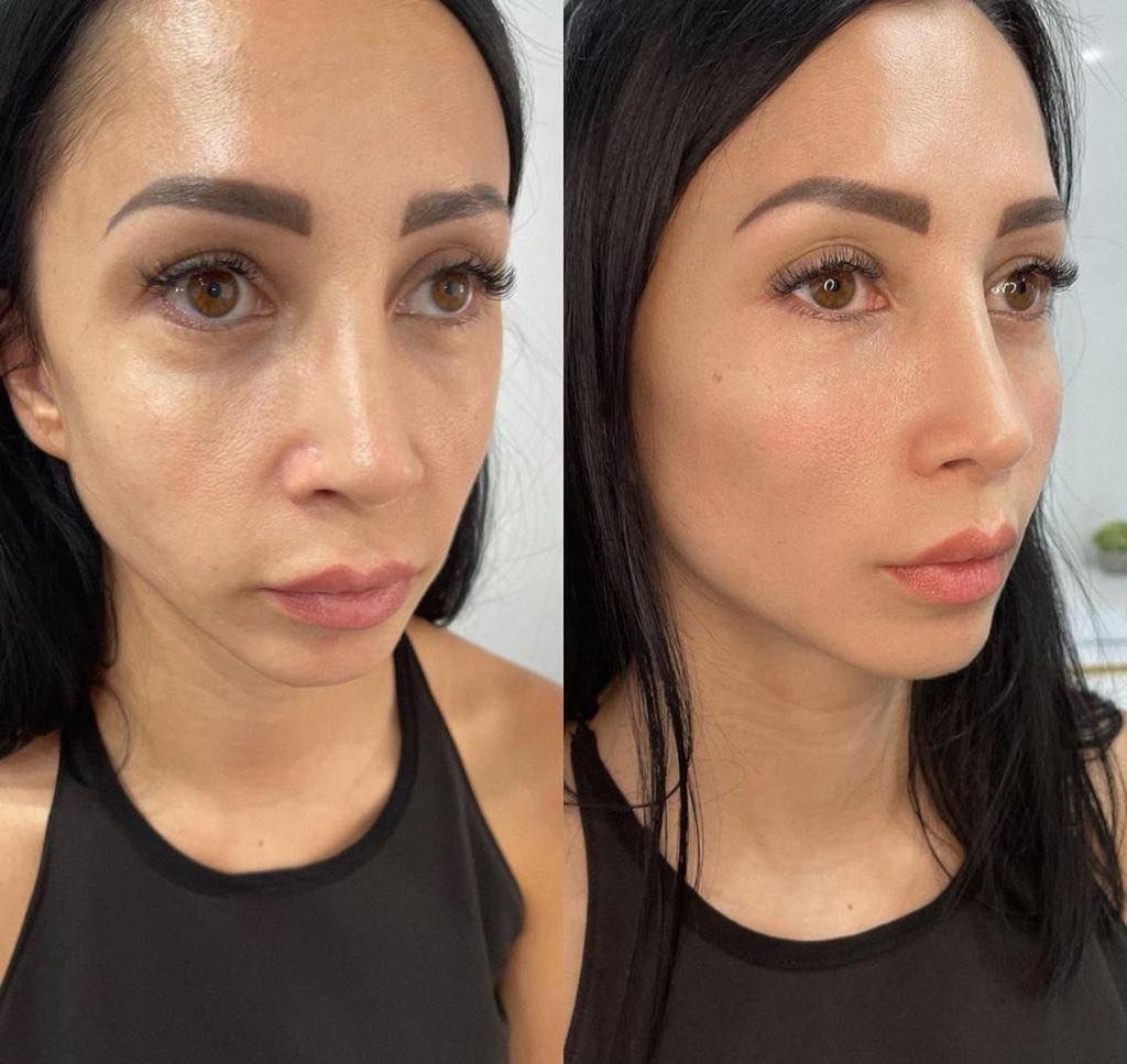 Clinica spa arte cuerpo  Facebook ad