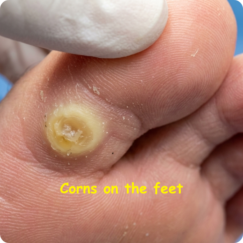 Wilson Health Paris Facebook ad: Foot Care, Ingrown Toenails, Orthotics. Contact today