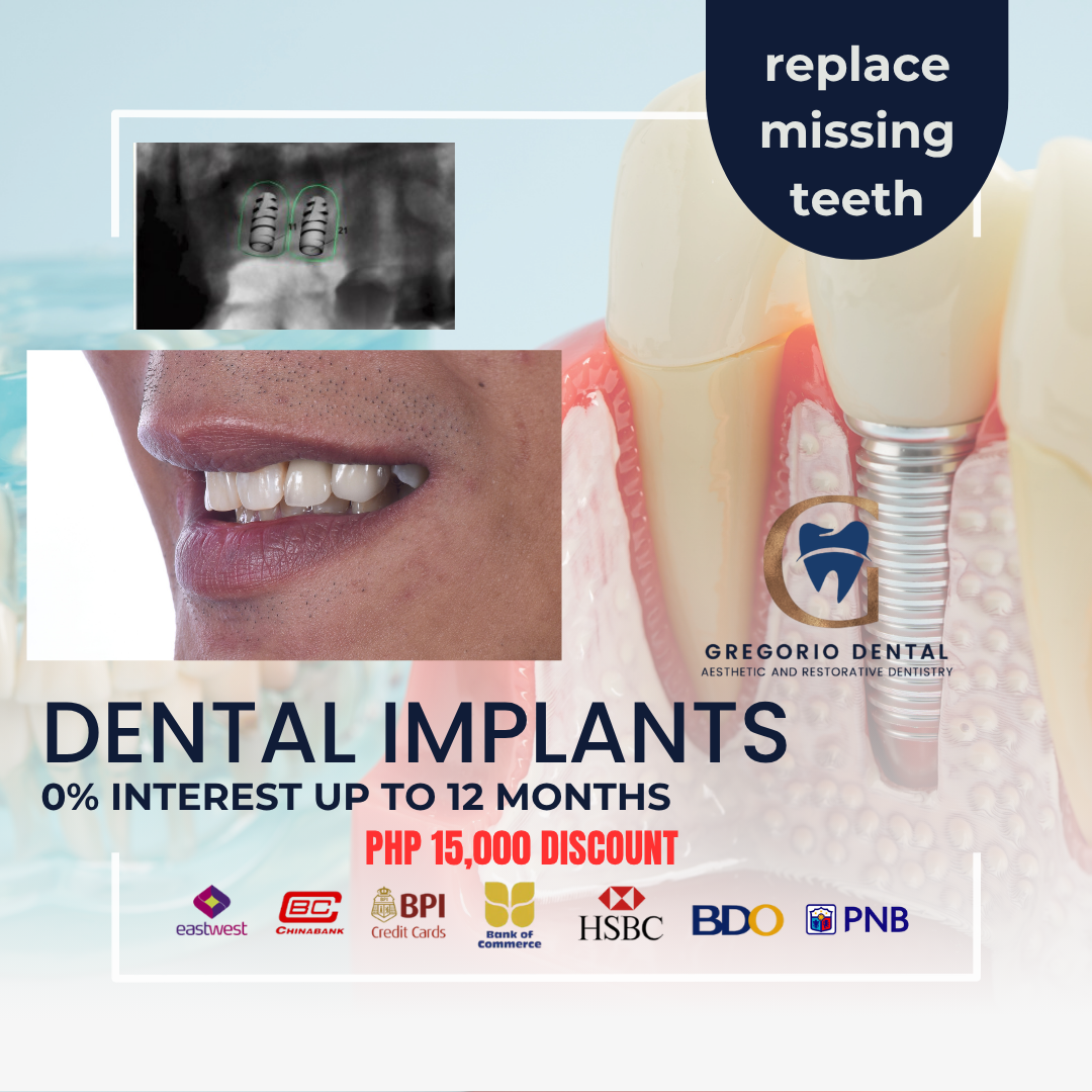Gregorio Dental Facebook ad