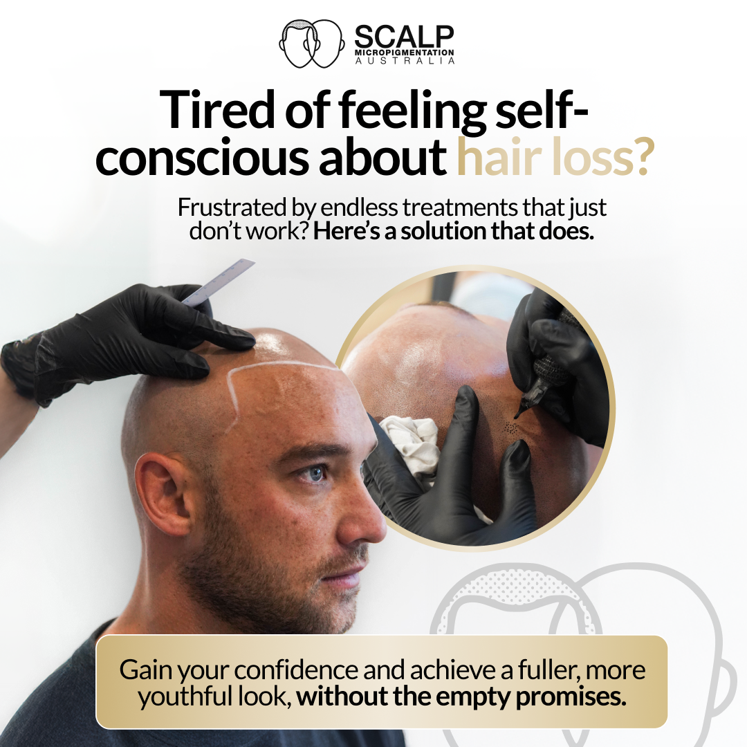 Scalp MicroPigmentation Australia Facebook ad