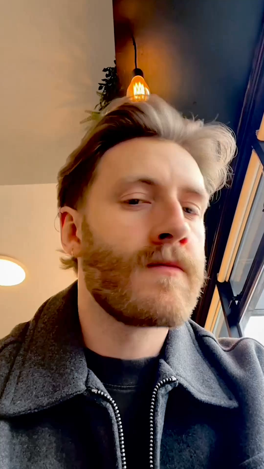 Sons Facebook ad: Get ahead of hair loss