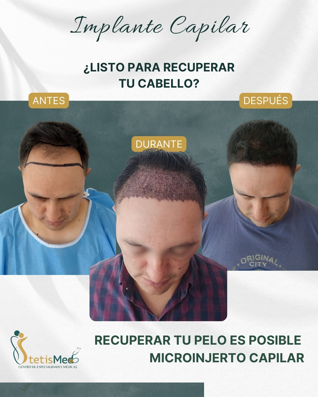 Stetis - Estética Integral Facebook ad: ¿Quieres volver a verte con más cabello… y…