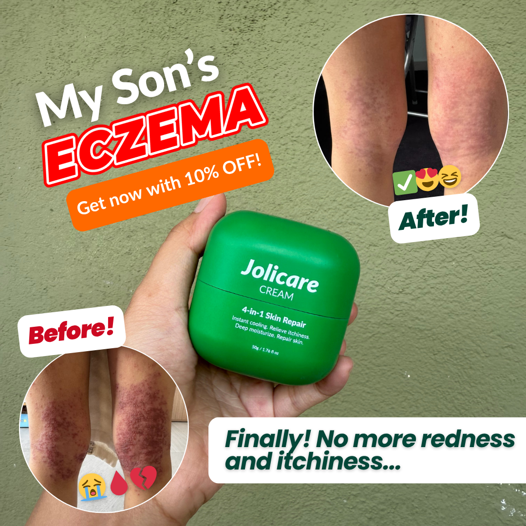 Jolicare - Repair Dry, Itchy & Sensitive Skin Facebook ad