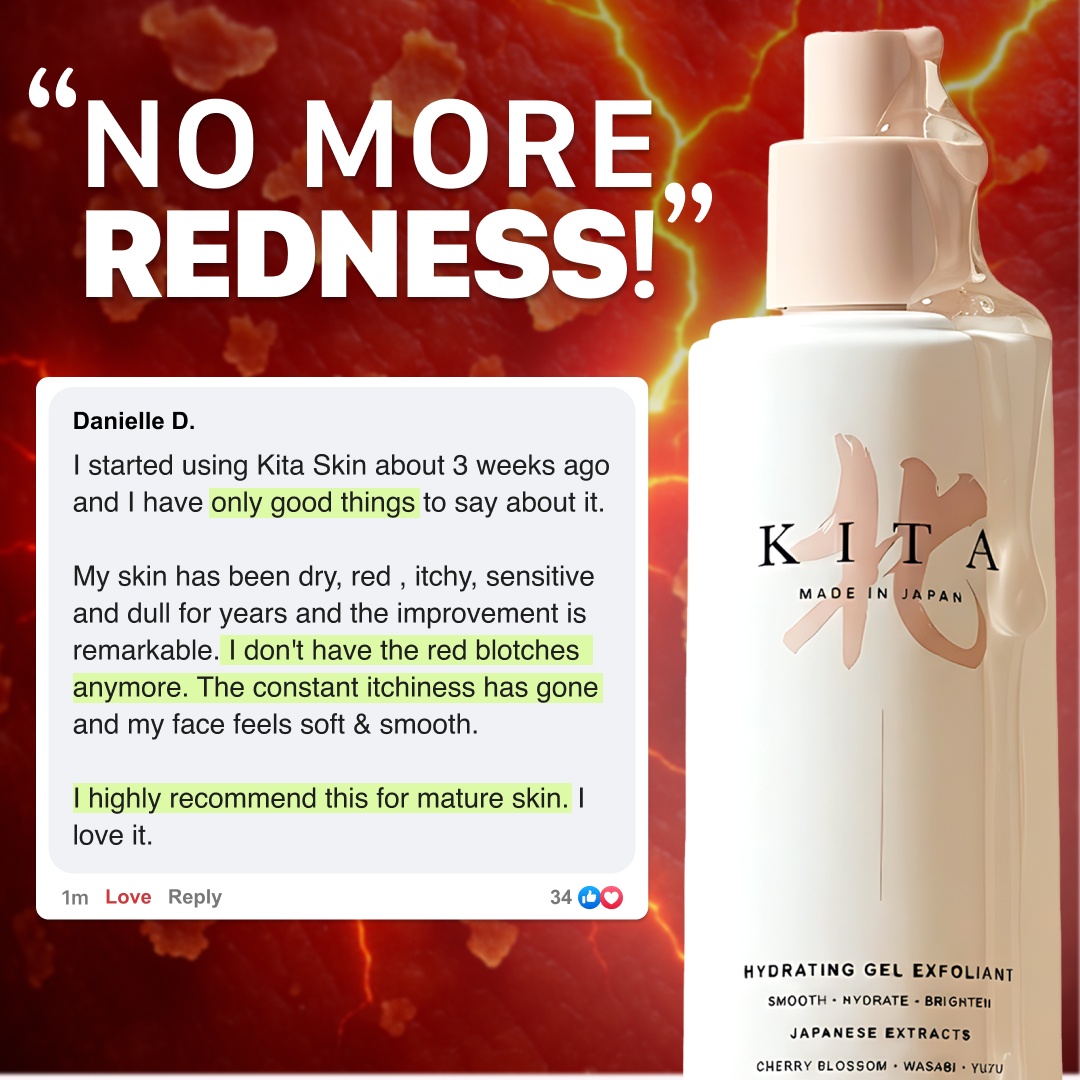 Kita Skin Facebook ad