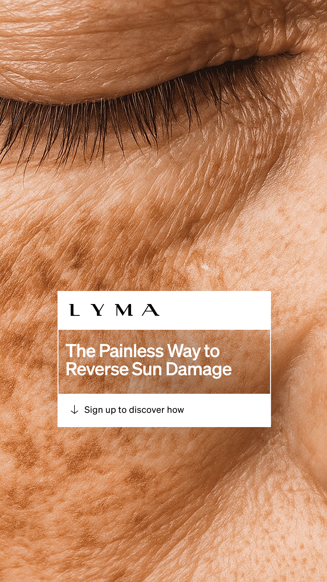 LYMA Facebook ad