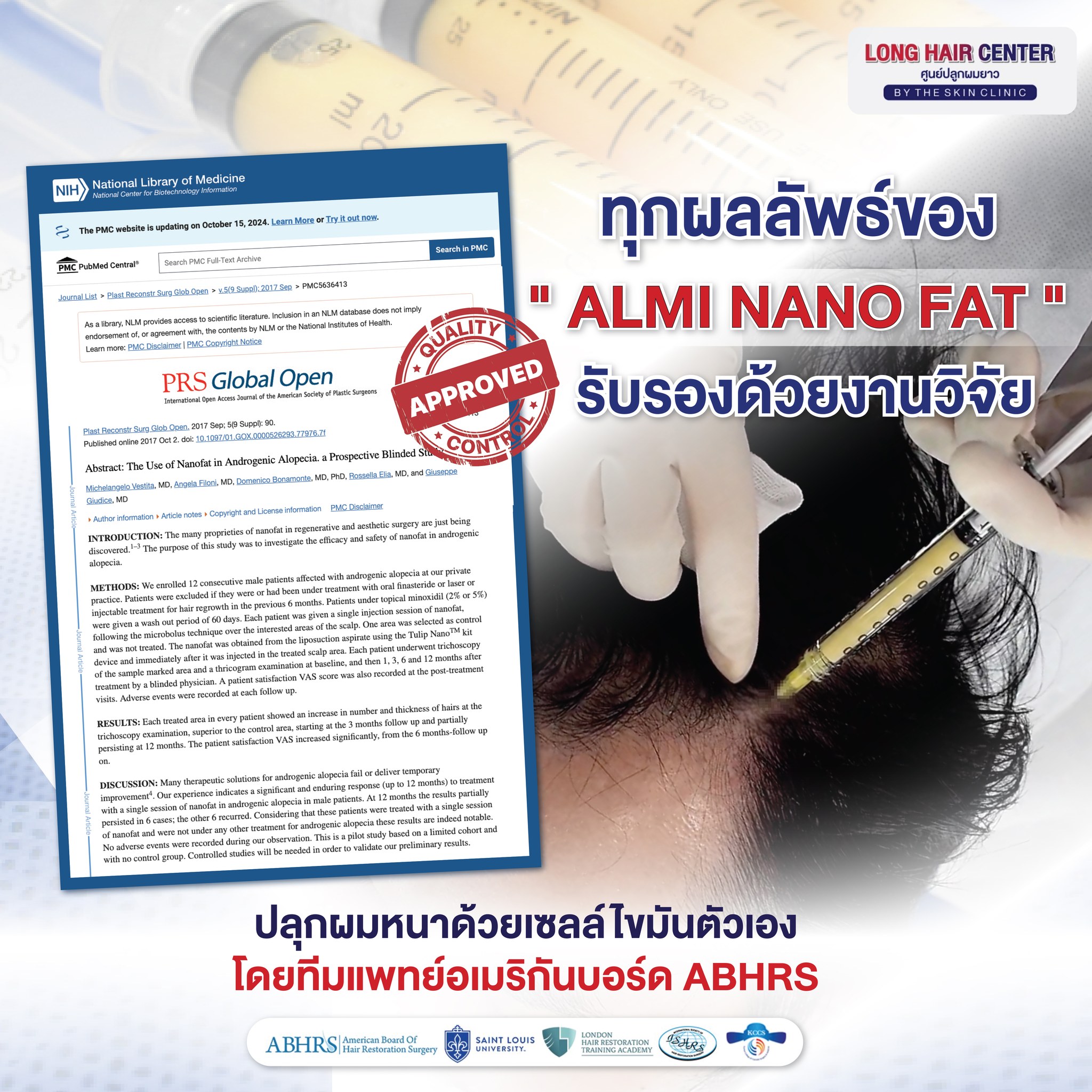 หมอท็อป ปลูกผมถาวร DR.TOP Hair Hospital โดยแพทย์อเมริกันบอร์ด Facebook ad: ปลูกผมด้วย ALMI Nano Fat ผลลัพธ์ที่มั่นใจได้…