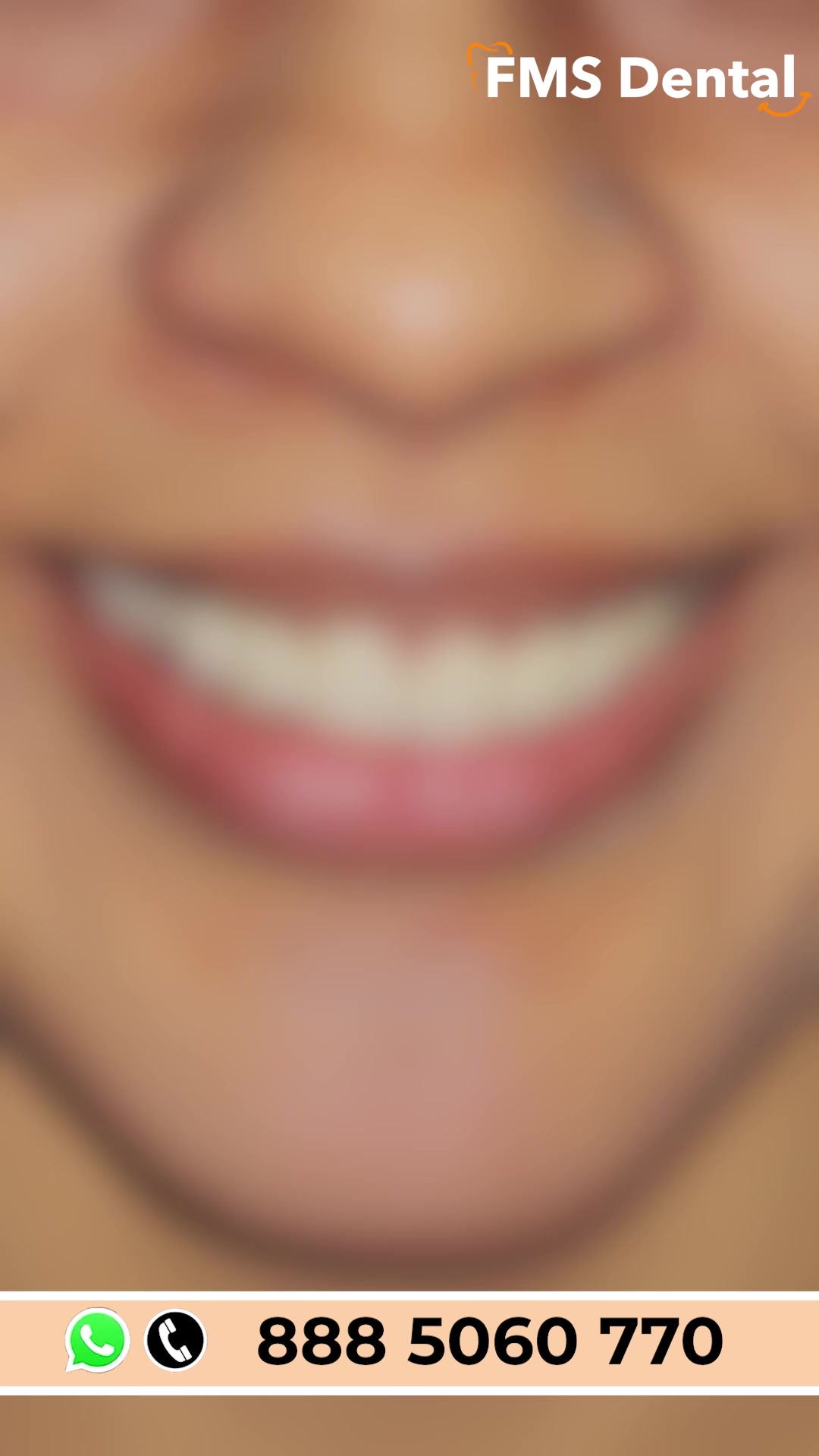 FMS International Dental Center Facebook ad: The Ultimate Smile Transformation!