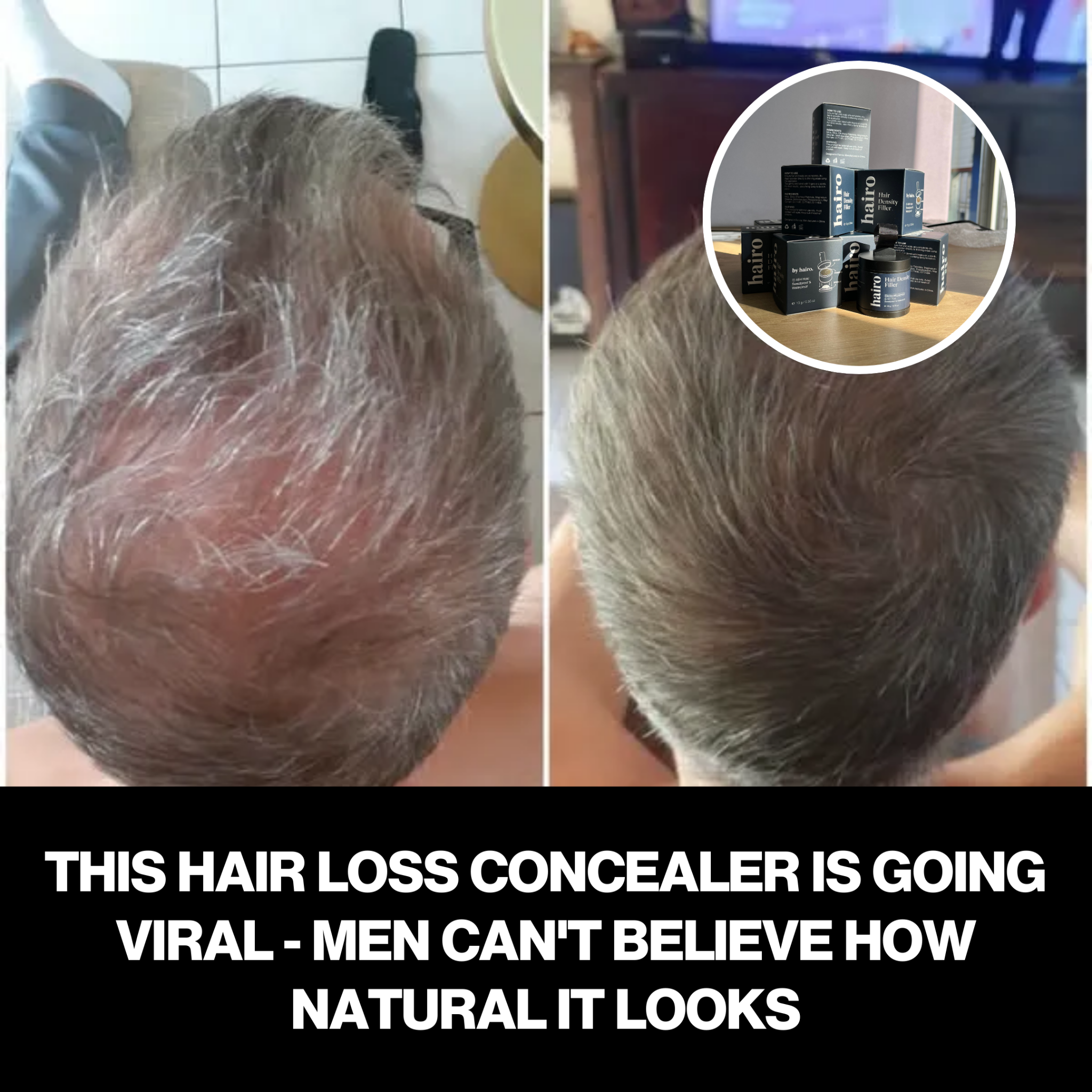 Hair Loss Insider Facebook ad