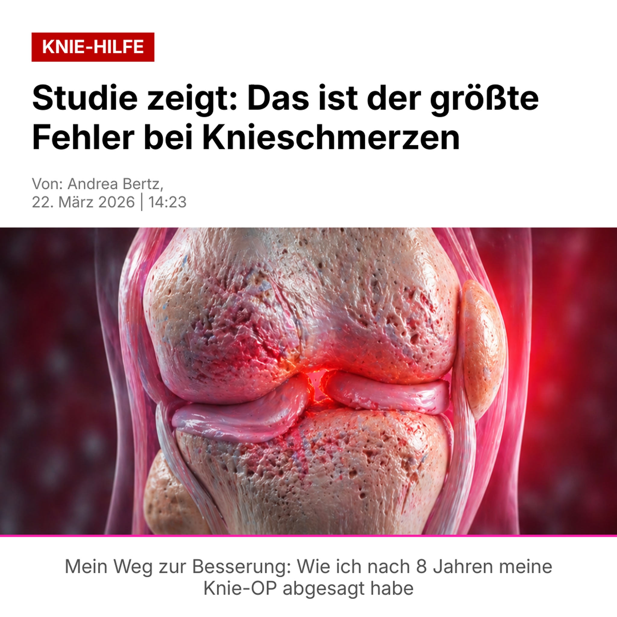 Heilkompass Facebook ad: Arthrose: Radiologin enthüllt die Wahrheit