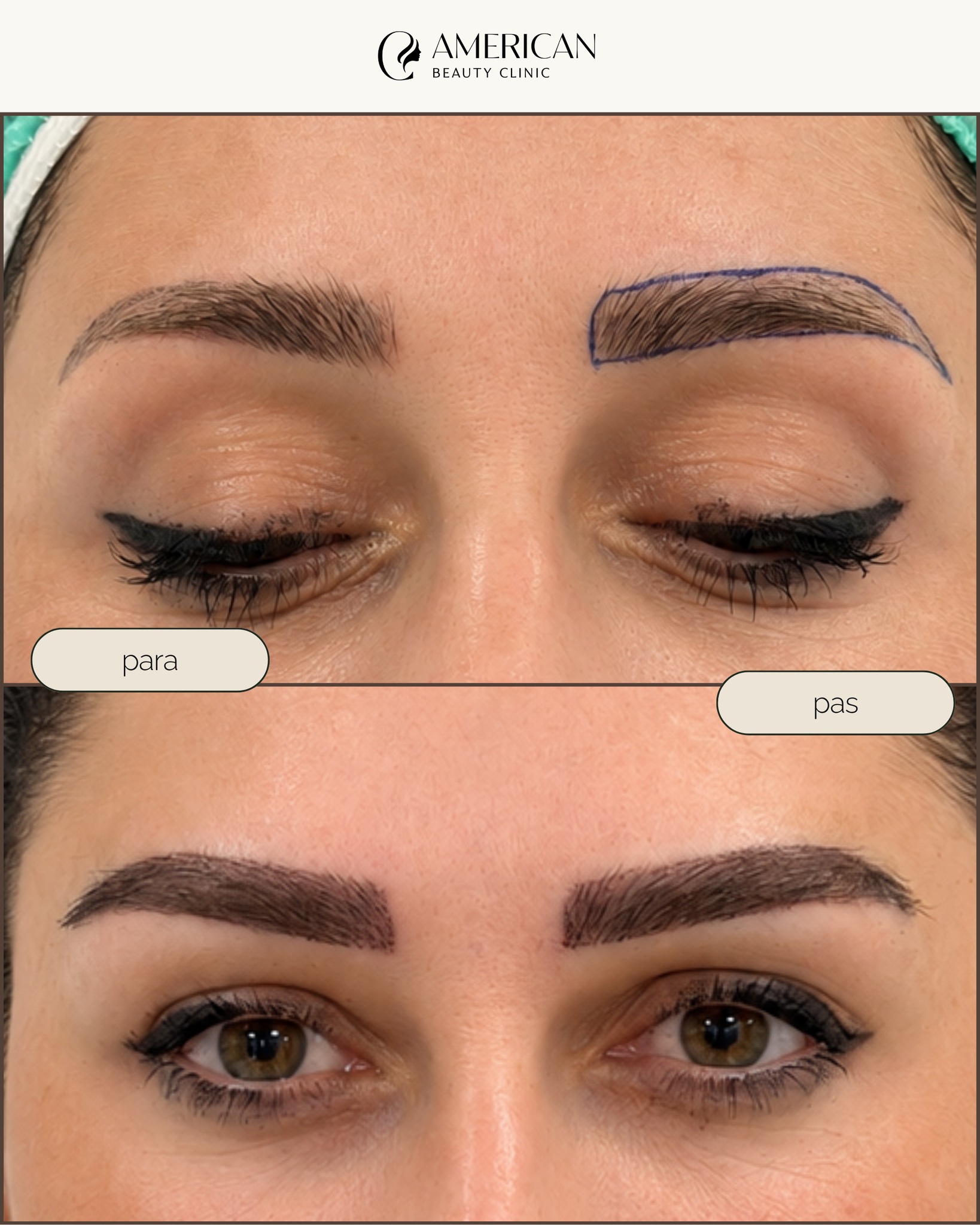 American Beauty Clinic Facebook ad: Në mbjelljen e vetullave me Long Hair Eyebrow…