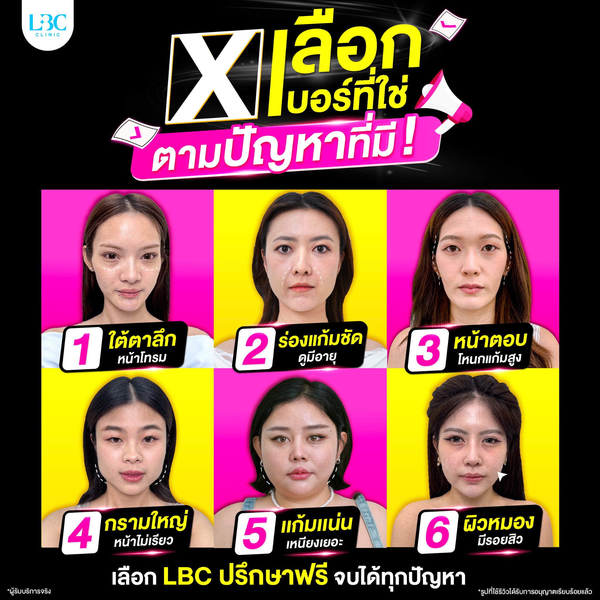 LBC Clinic เลอบิวทิส Facebook ad