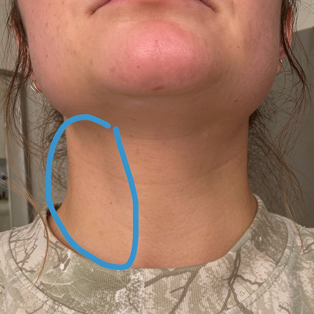 Artuvate Facebook ad