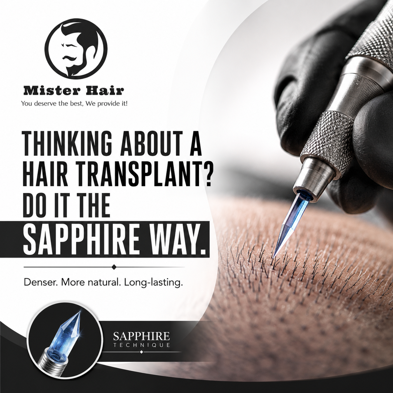 Mister Hair Clinic Facebook ad: Thinking about a Hair Transplant?
