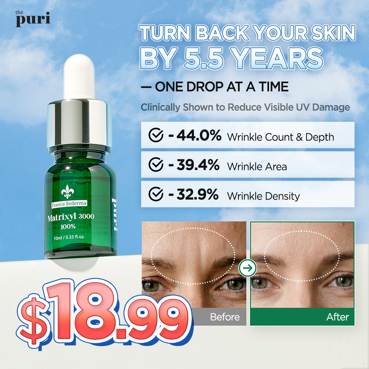 Thepuri Facebook ad: Matrixyl 3000 100% Peptide Serum