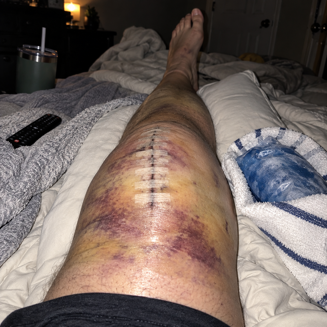 Kathy Miller Facebook ad: 12 years of bone-on-bone knee pain gone in 2 days?