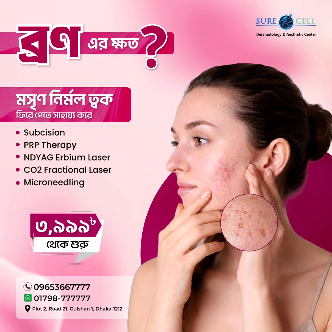 Surecell Medical Bangladesh Facebook ad: Acne Scars? Get The Best Solution