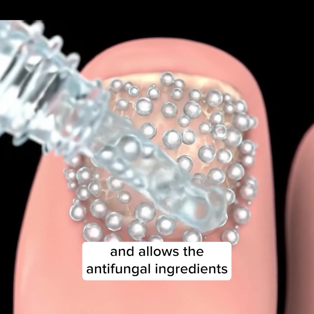 Healing Natural Oils Facebook ad: Clear Up Nail Fungus Symptoms in No Time