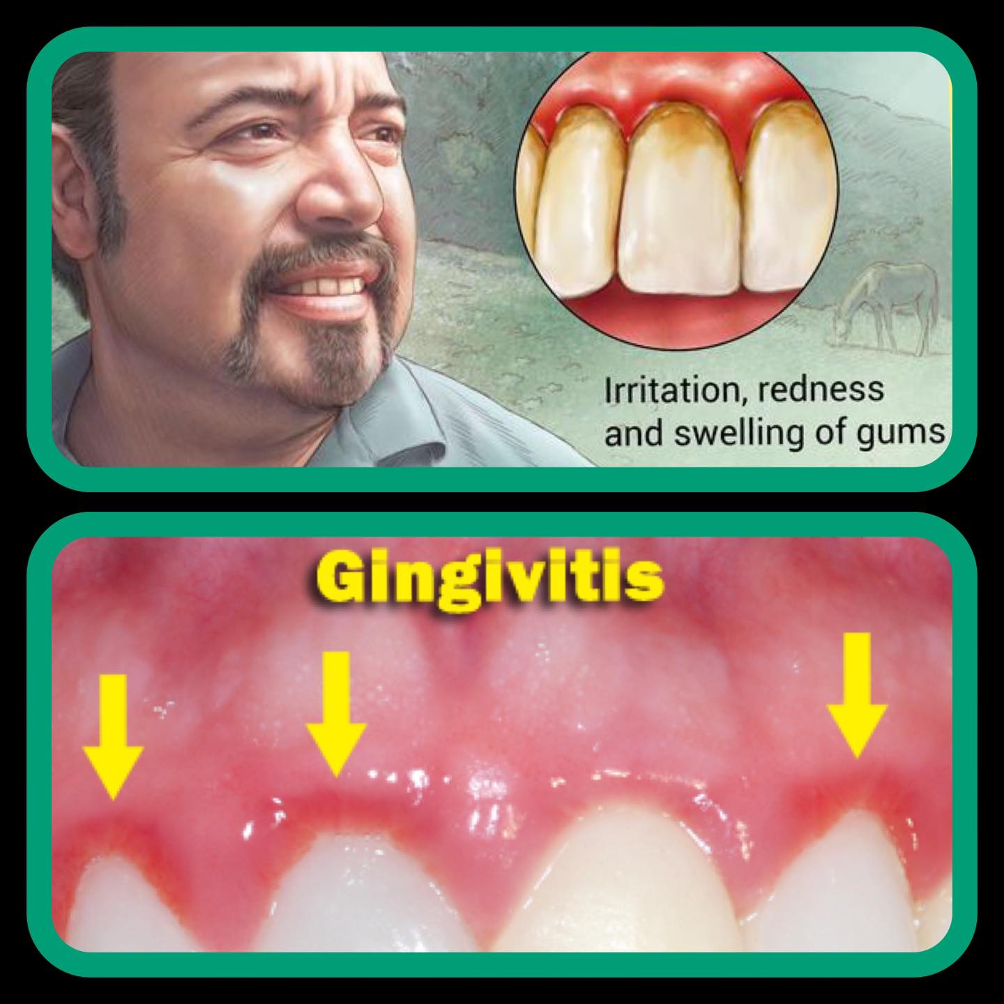 Lamana Dental Clinic Facebook ad