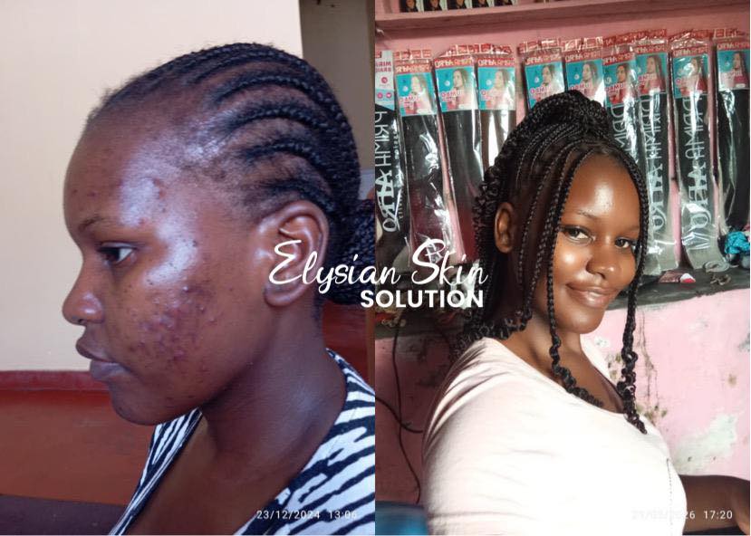 Elysian Skin Solutions Facebook ad: Kodi Mtsikana,Mnyamata, Amayi ndi Abambo