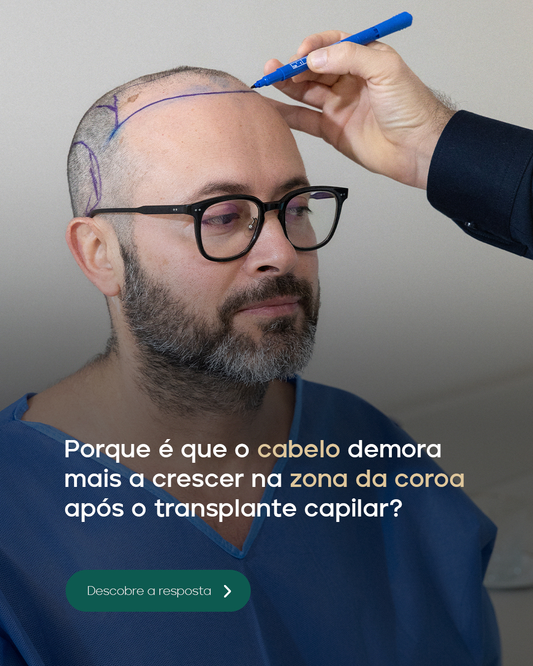 Hairvolution - Centro Avançado de Medicina Capilar Facebook ad: Fizeste um transplante capilar… e agora queres garantir…