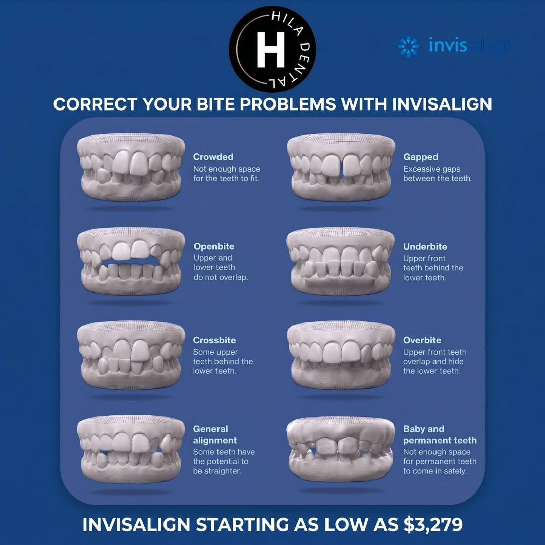 Hila Dental Clearwater Facebook ad