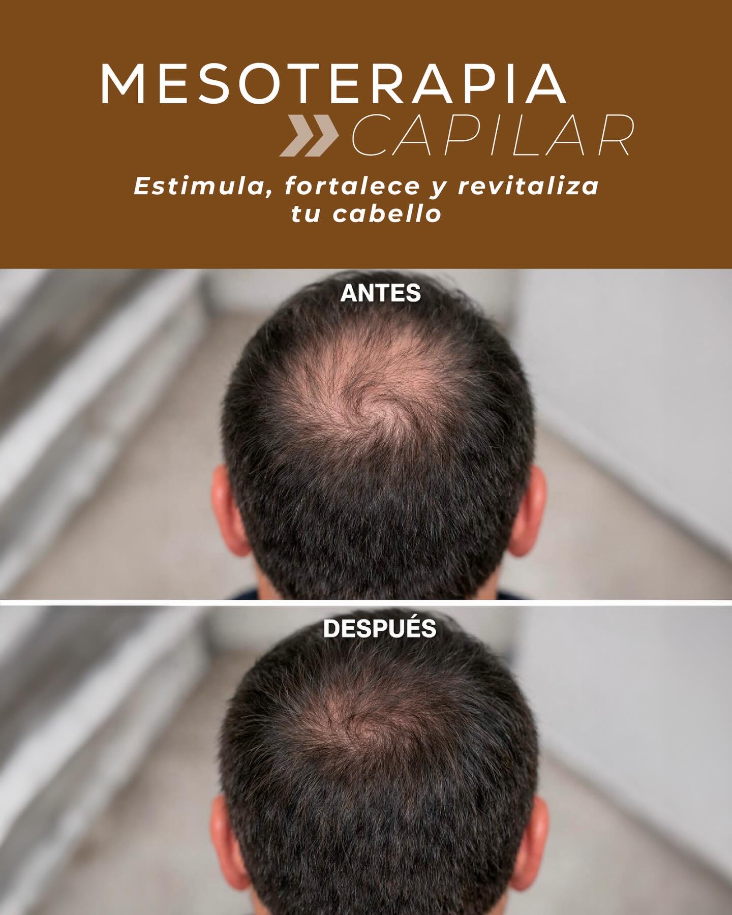 Dermiere Facebook ad: ¿Notas tu cabello más fino, débil o con…