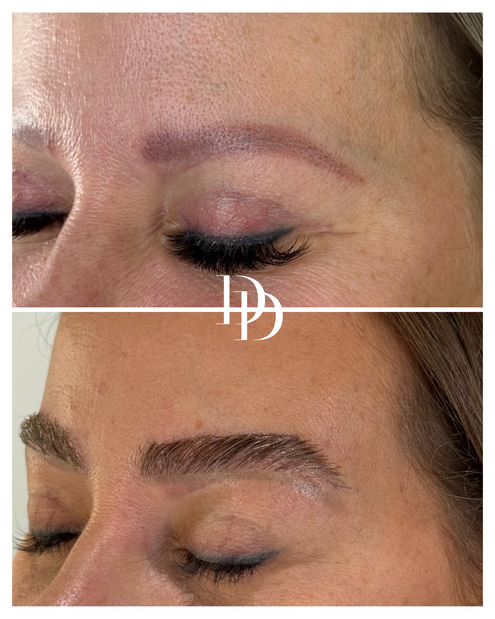 Dr. Ducu Facebook ad: Send us a private message for Eyebrow Transplant…