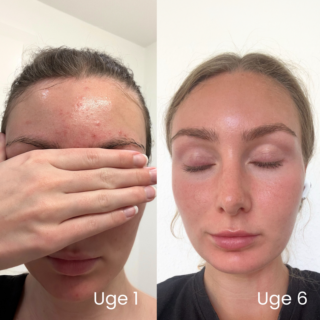 Derma Space Facebook ad