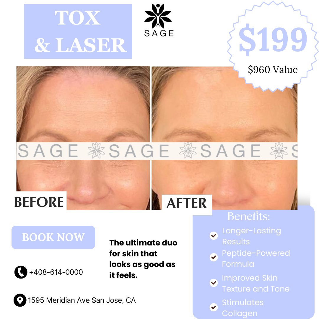 Sage Health & Wellness Center Facebook ad: Tox and Laser $199