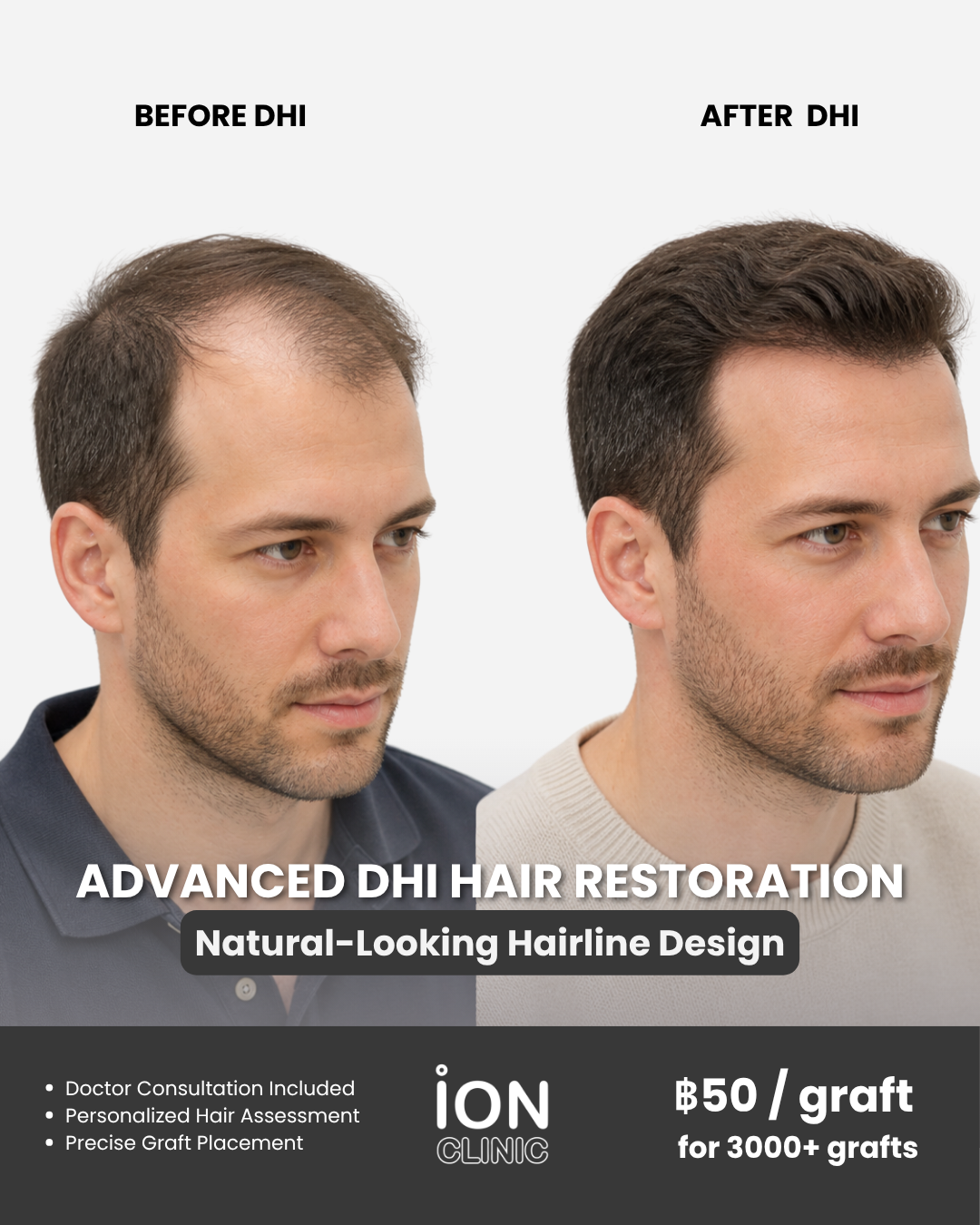 ION Clinic Bangkok Facebook ad