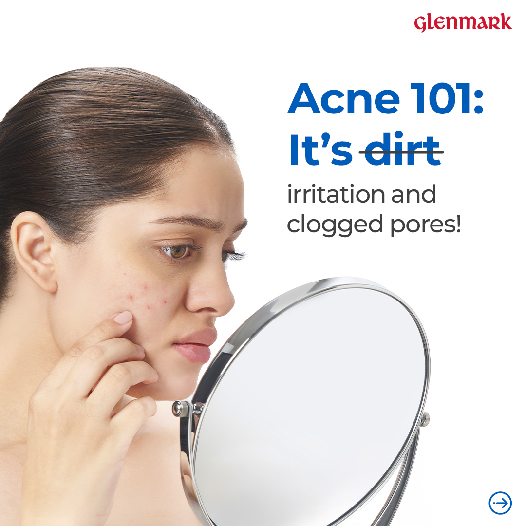 D'Acne by Glenmark Facebook ad: With niacinamide and glycolic acid, D’Acne Face Wash…