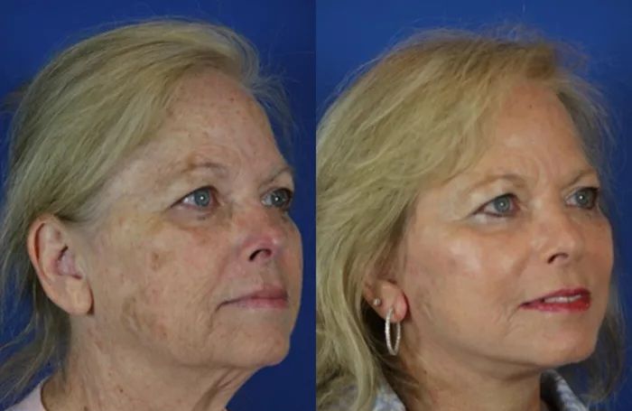 Advanced Skincare & Aesthetics Facebook ad