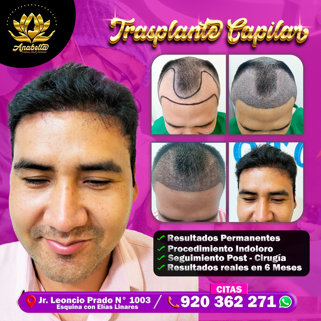Anabella- Studio Spa Facebook ad