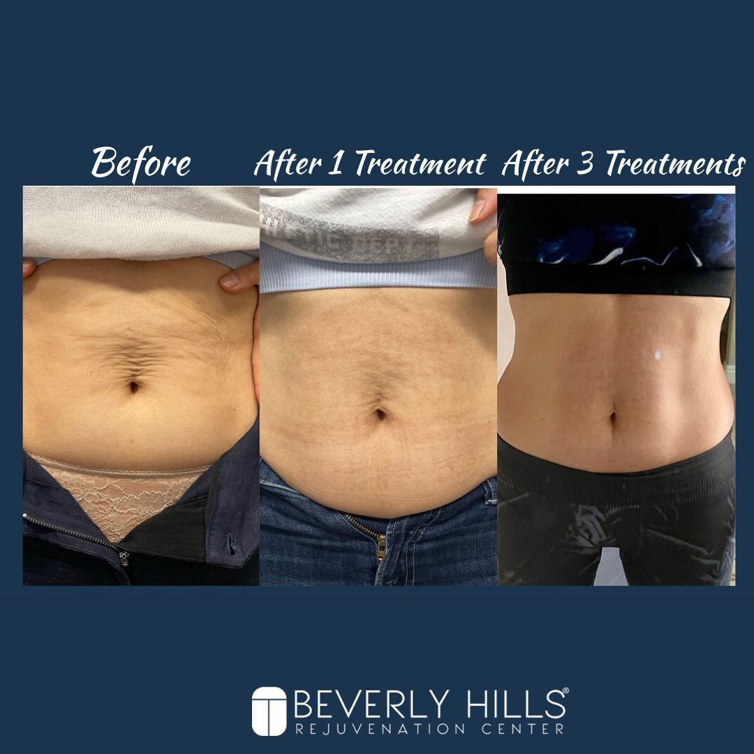 Beverly Hills Rejuvenation Center - Westlake Village & Valencia Facebook ad