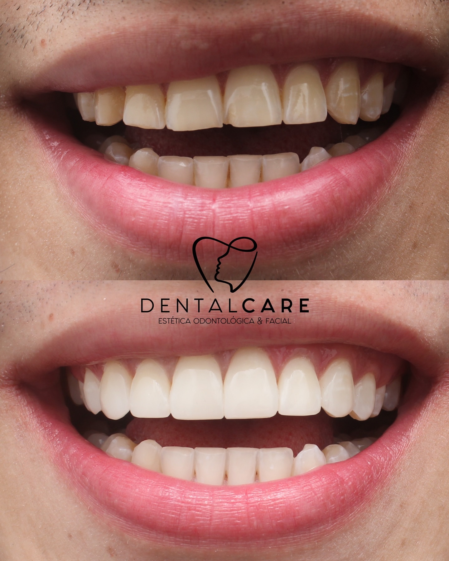 Dental Care Odontologia Facebook ad