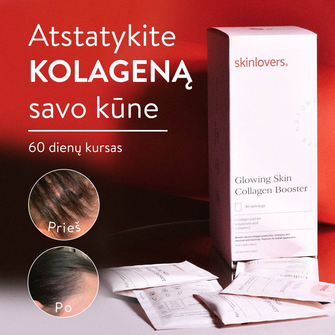 Skinlovers Facebook ad
