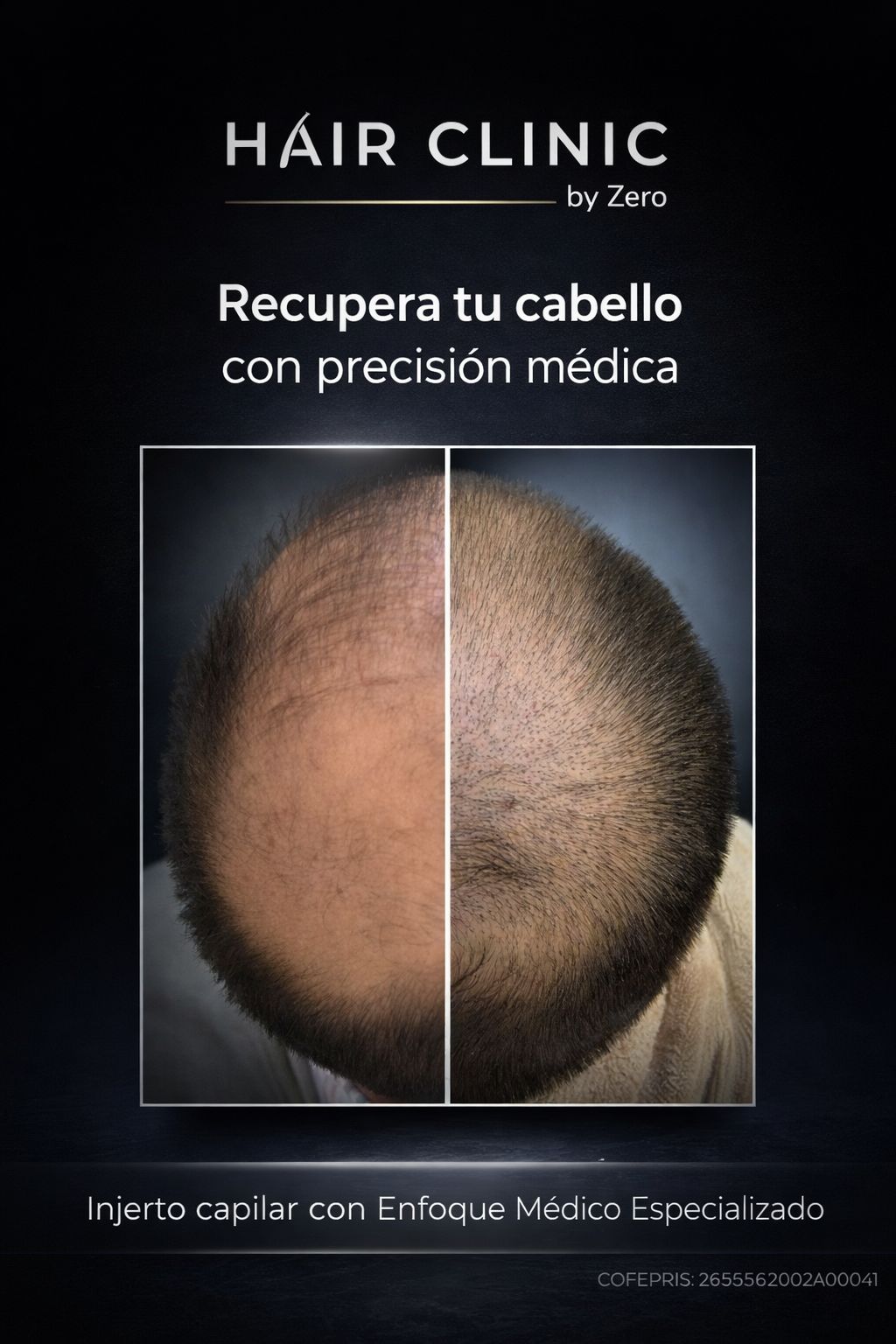 Hair Clinic By Zero Facebook ad: ¡Agenda una cita de valoración!